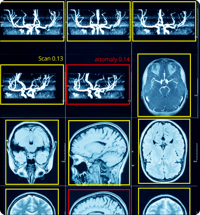Medical Anomaly Detection