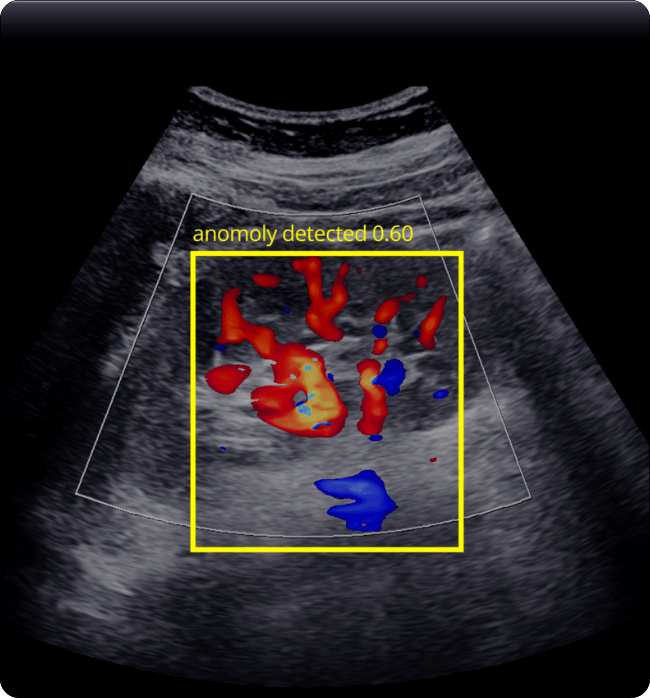 Medical Anomaly Detection