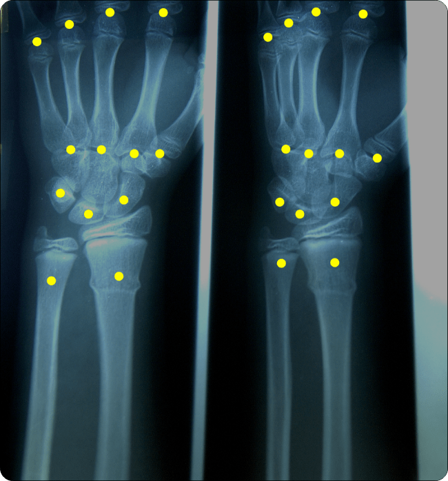 Medical Anomaly Detection