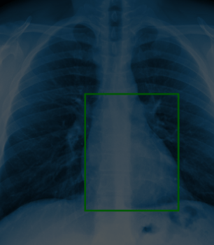 X-ray Film Classification