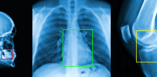 X-ray Film Classification