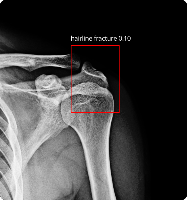 X-ray Film Object Localization
