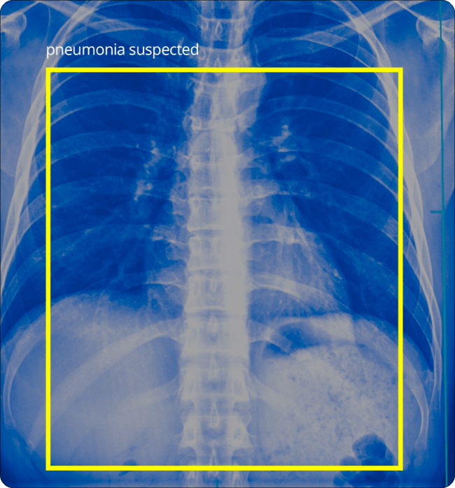 Xray-scan film classification