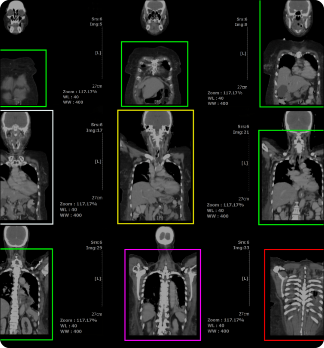 Xray-scan film classification